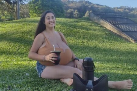 Estudante com gigantomastia faz cirurgia e retira 10 kg de mama 