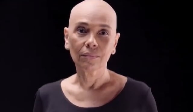 Cris Monteiro alopecia vereadora